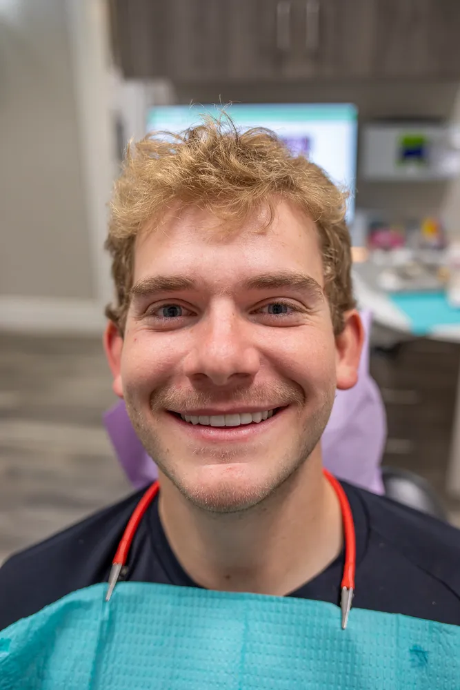 Natural-looking dental veneers result — Deluxe Dental Kuna Idaho cosmetic dentist