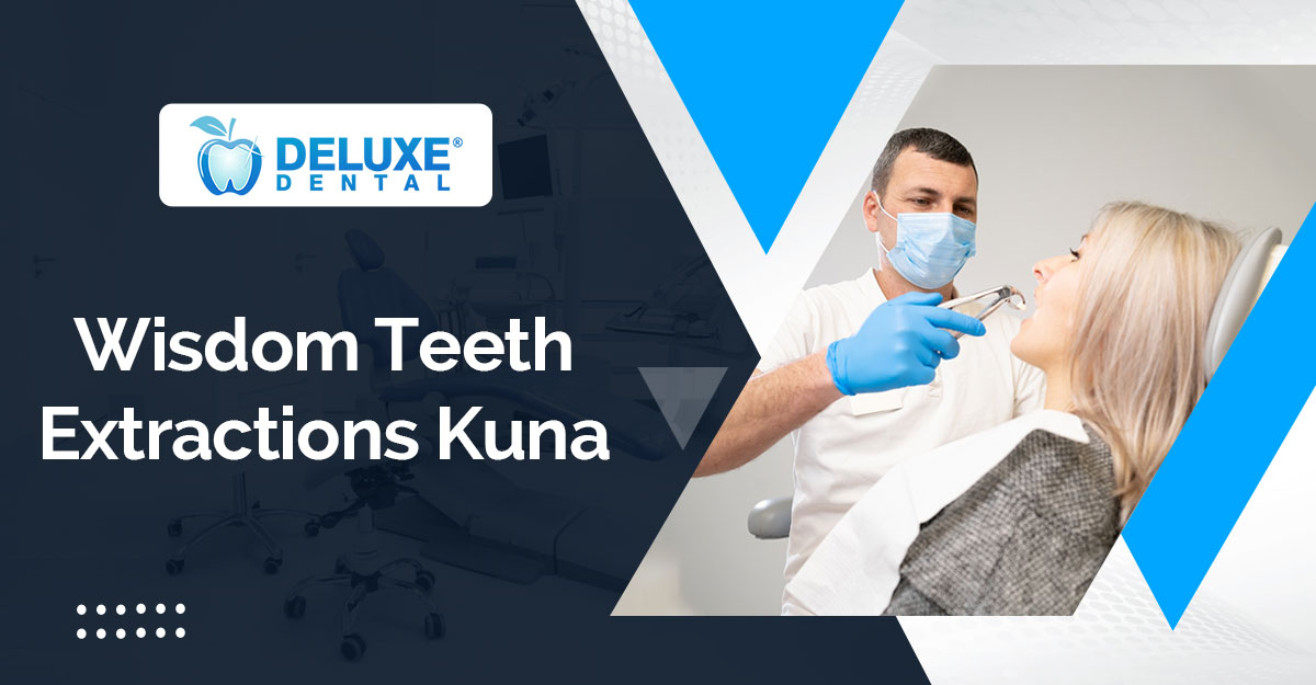 Wisdom Teeth Extraction Kuna