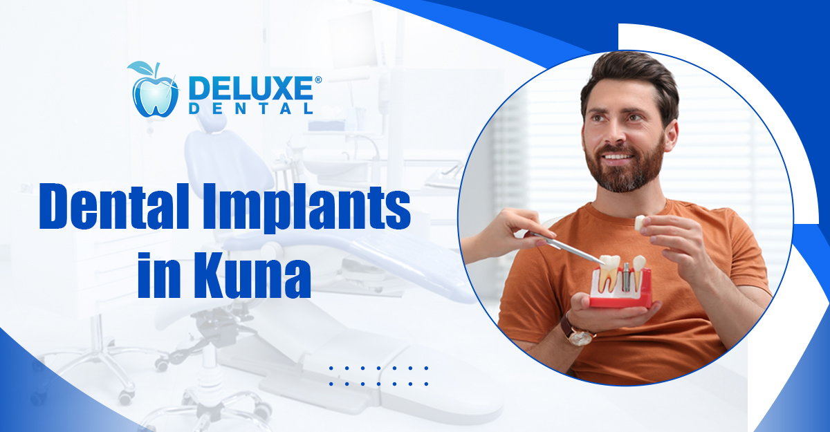 Dental Implants in Kuna